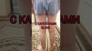 ПСОРИАЗ У РЕБЕНКА!!! 👆👆👆