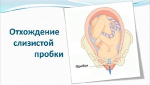 Предвестники родов.