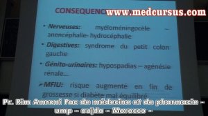 Nouveau né de mère diabétique - Pr. Rim AMRANI fac de médecine oujda morocco