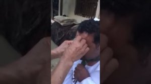 Кровепускание через лоб.