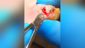 Перевязка?? • Как всё заживает??