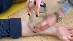 Первая помощь при укусе насекомых