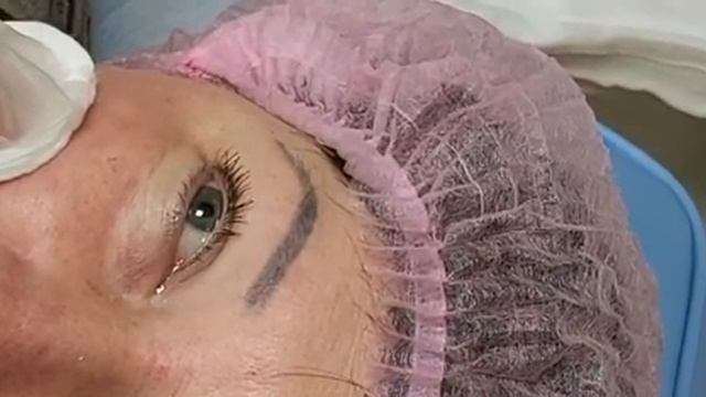 АирисКом студенты учатся: липолитические коктейли для удаления мешков под глазами.
