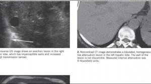 GIT MC GRAW HILL RADIOLOGY BOOKS FRCR(1)