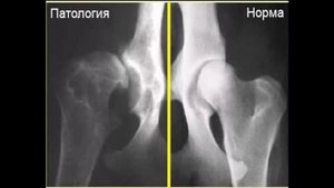 Дисплазия тазобедренных и локтевых суставов у собак — международные обозначения
