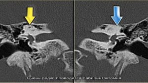 Болезни внутреннего уха и их симптомы