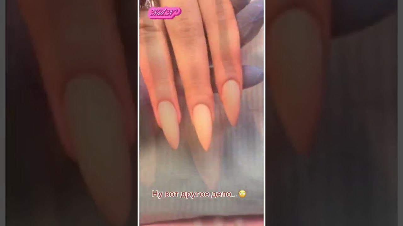 СЛОЖНАЯ КОРРЕКЦИЯ