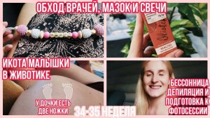 ИКОТА МАЛЫШКИ ◈ ОБХОД ВРАЧЕЙ ◈  ПЛОХОЙ МАЗОК И СВЕЧИ ◈ 34 - 35 неделя ◈ Влоги беременной Сашки