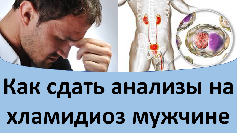 Как сдать анализы на хламидиоз мужчине