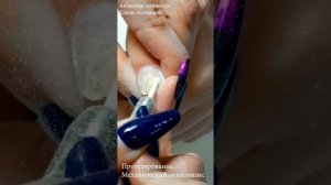 Ремонт НОГТЕЙ. Протезирование. Онихолизис.