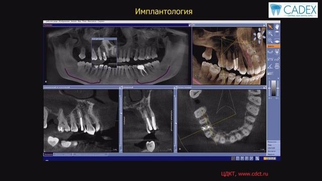 КЛКТ НА ПЕРВИЧНОМ ПРИЕМЕ ВРАЧА СТОМАТОЛОГА