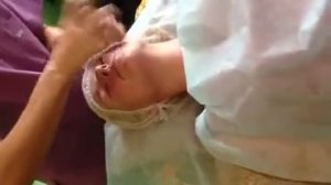 Вьетнамский массаж лица