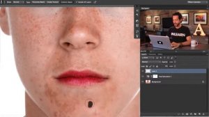 "APs RETOUCH": Как удалить крупные прыщи