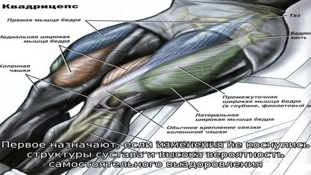 Вывих надколенника