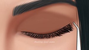 ASMR Remove unmanaged eyebrow piercing pus animation | Squeeze eyes acne