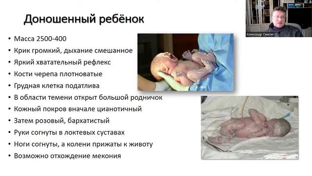 Физиологические особенности новорождённых (2 часть) смотреть онлайн