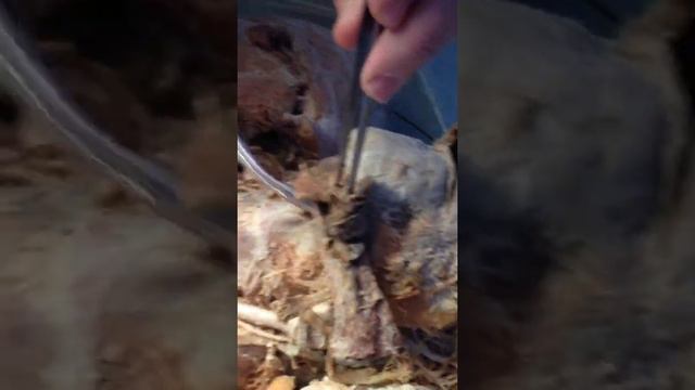 Носовая полость и гортань смотреть онлайн