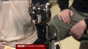 Протез руки