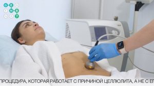 Устранение целлюлита и рубцов Skinova Pro Сеть клиник косметологии GEN87
