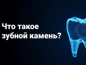 Стоматолог Кудин Денис Викторович: Что такое зубной камень? Почему образуется зубной камень?