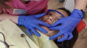 ДО и ПОСЛЕ ! Сняла брекеты! Результат * неожиданно *