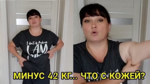 КОЖА ПРИ ПОХУДЕНИИ / ОТКРОВЕННО О ШОКИРУЮЩЕМ / ЧТО БУДУ ДЕЛАТЬ С КОЖЕЙ?