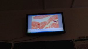 Гистология. Мочевой пузырь