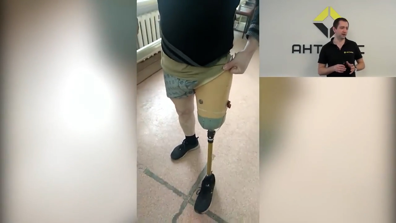 Мой первый протез. Каким он быть (не) должен!