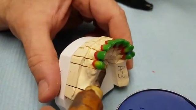 Работа с зуботехническим воском "Денест" (моделировочный, синий, соединительный) - 1 смотреть онлайн