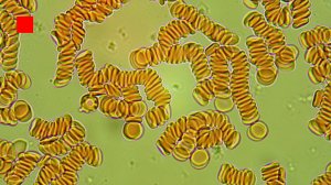 Основы гемосканирования - микроскопии нативной крови с комментариями врача, Вводное занятие, часть 1