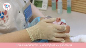 SMАS-лифтинг