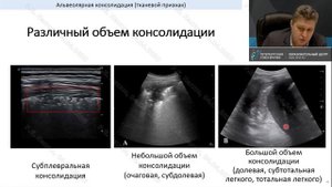 УЗИ лёгких в условиях ОРИТ Лахин Р.Е.