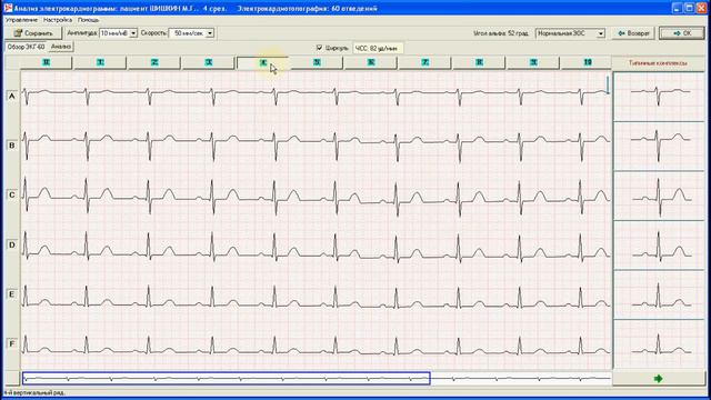 Кардиан-ПМ-Электрокардиограф смотреть онлайн