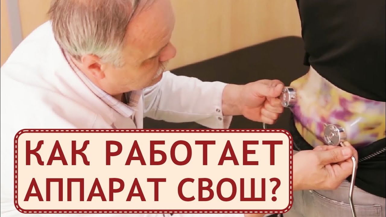 Аппарат СВОШ при лечении ДЦП, как правильно использовать. СВОШ ДЦП. Персей. 12+.mp4