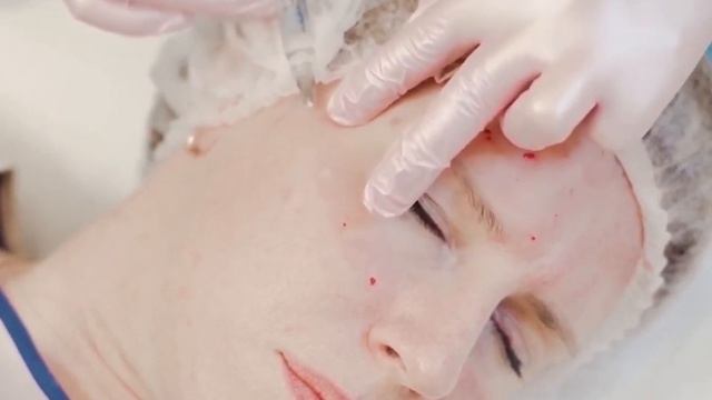 Протокол Repart 5 ACTIV смотреть онлайн