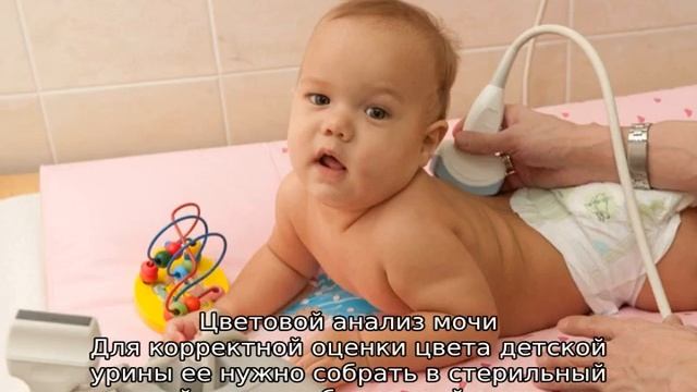 Бесцветная моча у ребенка — почему цвет урины прозрачный смотреть онлайн