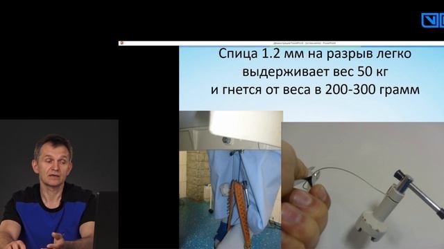 Лечение переломов что надо что бы перелом сросся. Частые ошибки при лечении переломов.