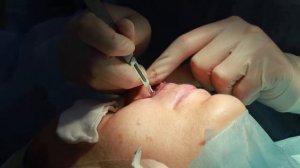 Булхорн часть 3