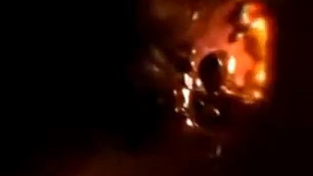 Поджелудочная железа Береги себя