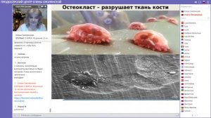 Восстановление костной и хрящевой системы Ольга Писарькова