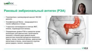 Онкомаркеры, особенности использования и интерпретации