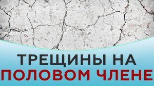 Трещины на половом члене