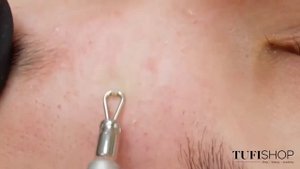 Инструменты для чистки лица
