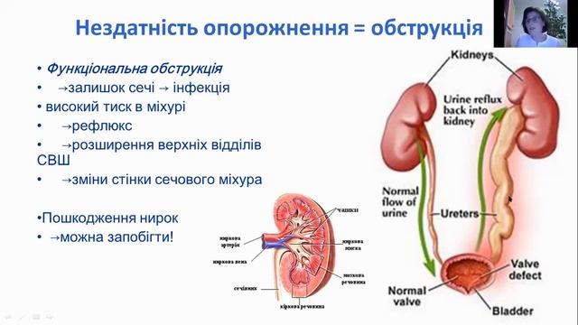 Вебінар 4 "Мультидисциплінарна опіка і попередження вторинних ускладнень"