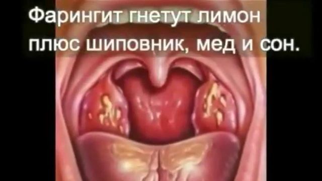 Народные рецепты смотреть онлайн