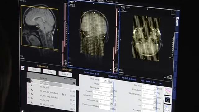 МРТ в Кинешме смотреть онлайн