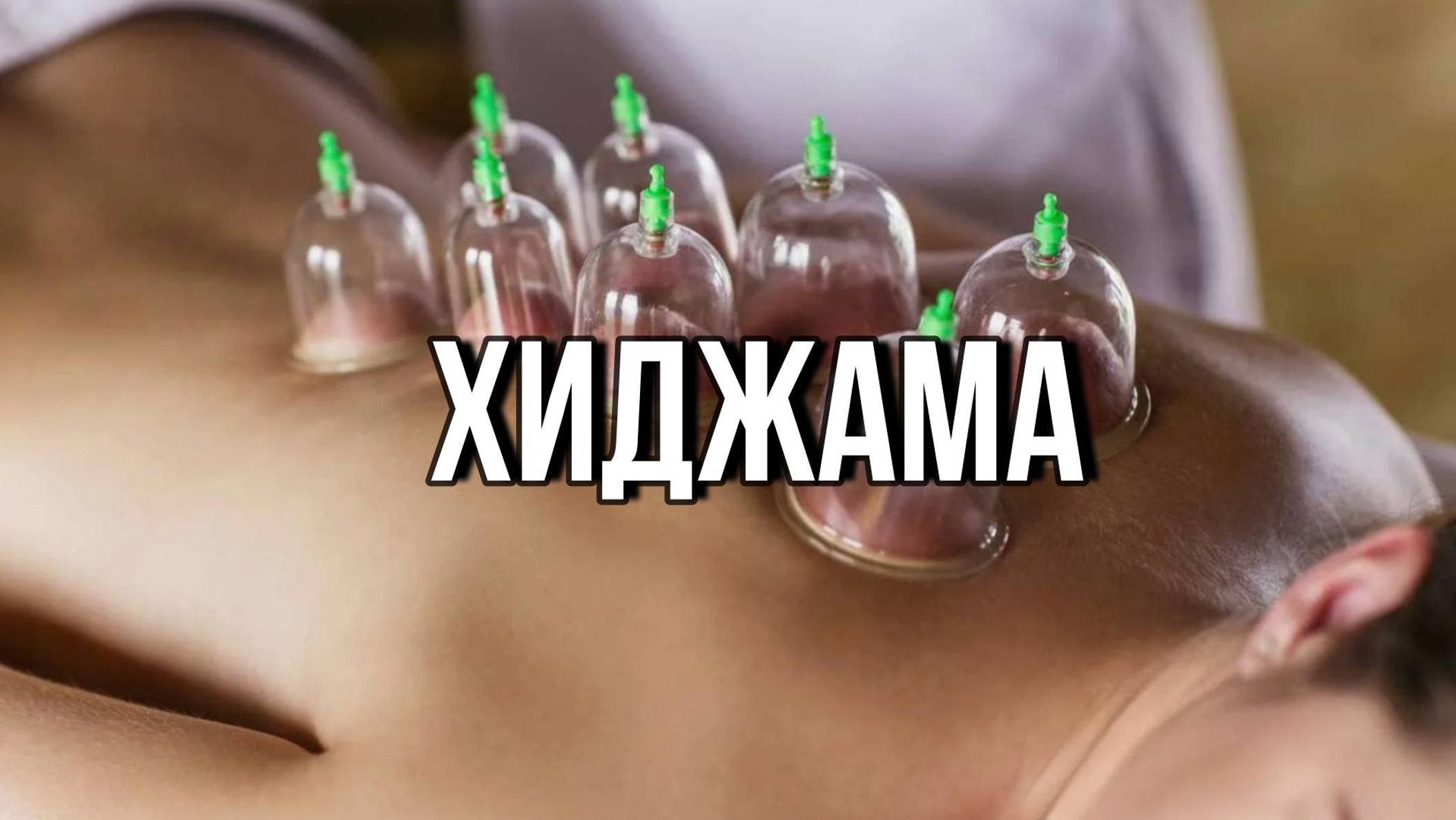 ХИДЖАМА