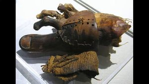 Медицина Древнего Египта