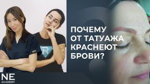 Почему от татуажа краснеют брови?