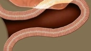 Копия видео Как работает наш желудочно кишечный тракт  http://prodlimmolodost.ru/